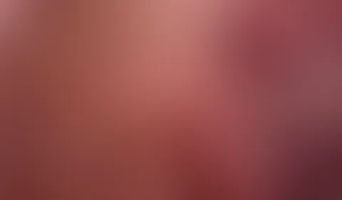 Fingern