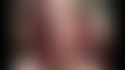 Teaser